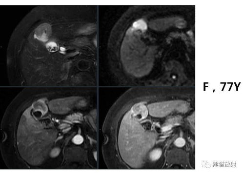 ÷���ܷ������_÷���ܳ�������