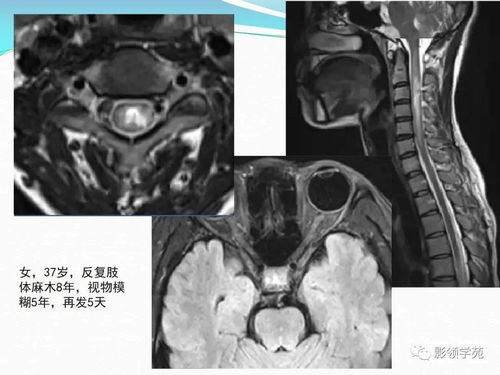 ���̲���֢״������