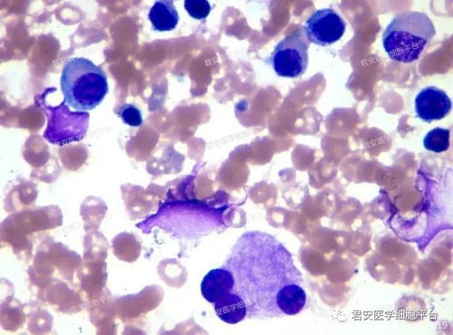 孕妇患梅毒该怎么办 孕妇患梅毒该怎么办