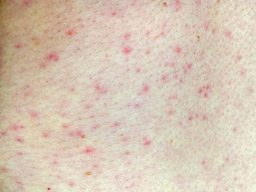 艾滋病有多少种病 艾滋病有多少种病原体 艾滋病有多少种病 艾滋病有多少种病原体