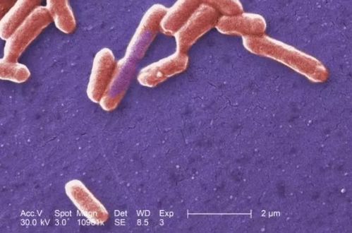 检测方法 艾滋病PK梅毒 检测方法 艾滋病PK梅毒
