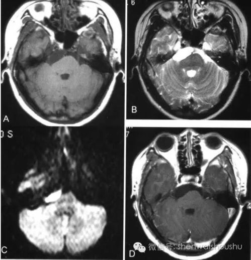 盆地灵魂兽(盆地灵魂兽刷新时间) 盆地灵魂兽(盆地灵魂兽刷新时间)