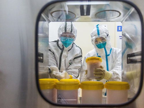 青光眼早期是什么症状 青光眼早期是什么症状