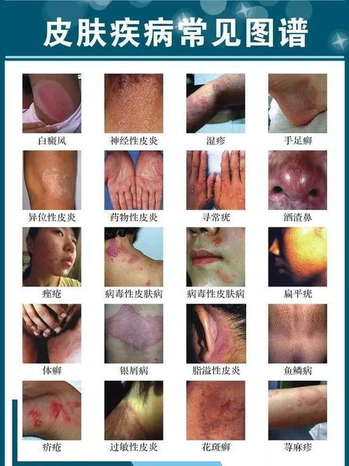 ���䲻�� ���䲻����̨��