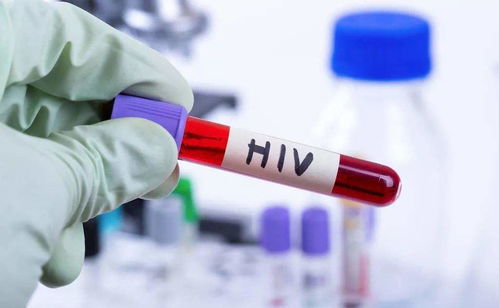 急性白血病是低烧还是高烧 急性白血病是低烧还是高烧