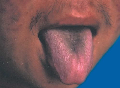 萧亚轩艾滋病(萧亚轩否认感染艾滋) 萧亚轩艾滋病(萧亚轩否认感染艾滋)