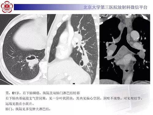 ÷ʲô֢״  Ԥ÷ĴʩЩ 