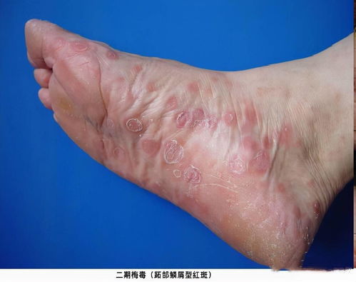 李维嘉回应暴瘦原因被曝得艾滋病 老婆背景前任是谁遭扒 李维嘉回应暴瘦原因被曝得艾滋病 老婆背景前任是谁遭扒