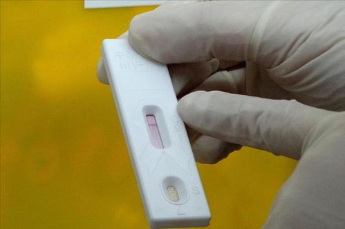 艾滋病初期症状 抑郁记忆力减退 艾滋病初期症状 抑郁记忆力减退