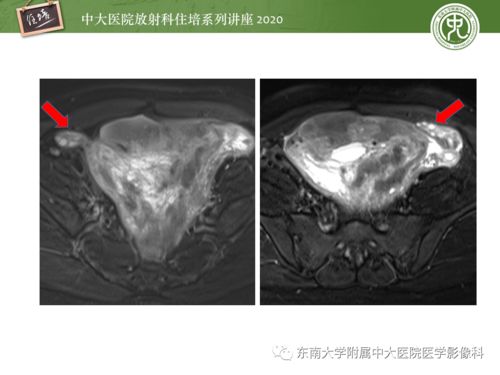 守望先锋全明星皮肤哪个值得买(守望先锋全明星皮肤返场吗) 守望先锋全明星皮肤哪个值得买(守望先锋全明星皮肤返场吗)