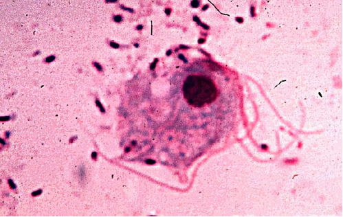 梅毒不同时期的危害 梅毒不同时期的危害