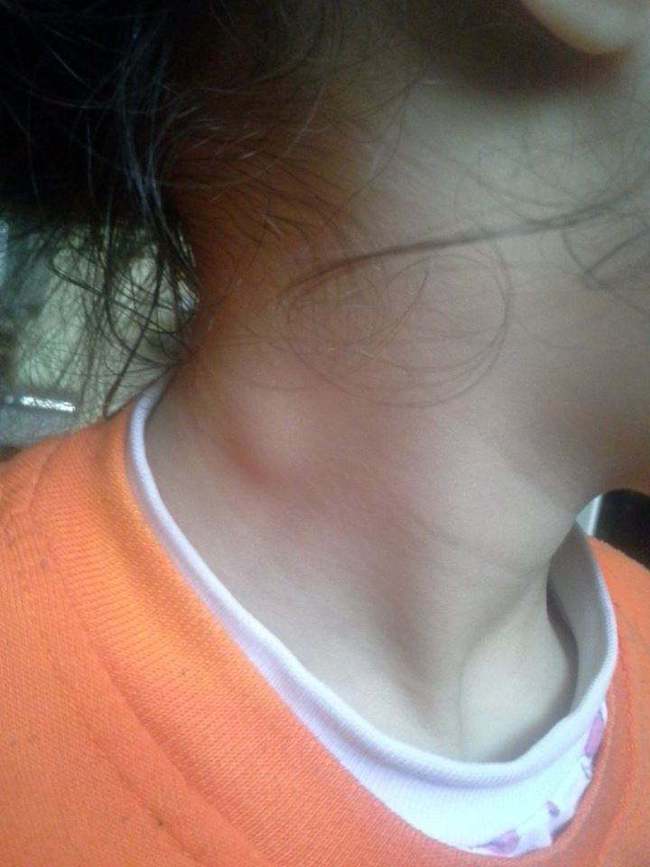 ��˵�����̲���ҩ�� ���Ϳ�Τ