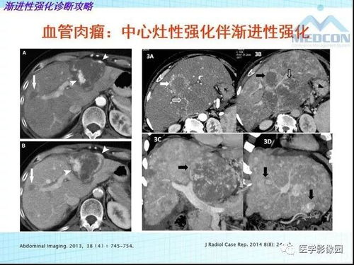 什么是模拟上课的软件(什么是模拟上课) 什么是模拟上课的软件(什么是模拟上课)