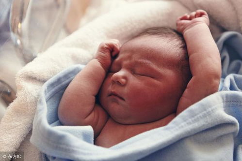 没有脓可以排除淋病么 没有脓可以排除淋病么