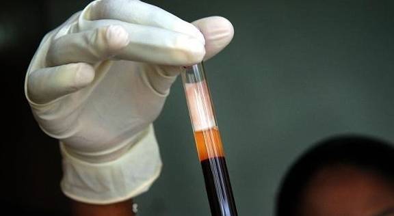 关于艾滋病感动的话英语 关于艾滋病感动的话英语