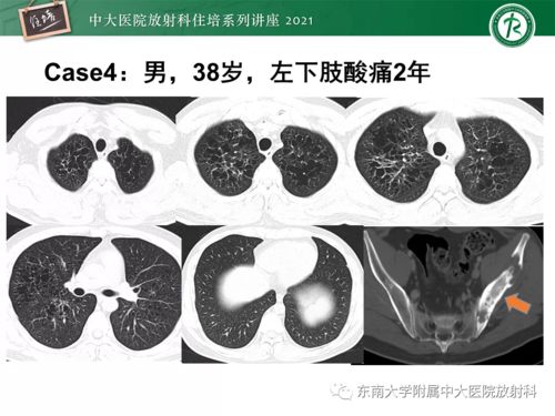 那年的我们(那年的我们的短句) 那年的我们(那年的我们的短句)