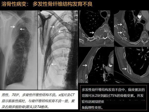 ϲ�������̫�ǰ�