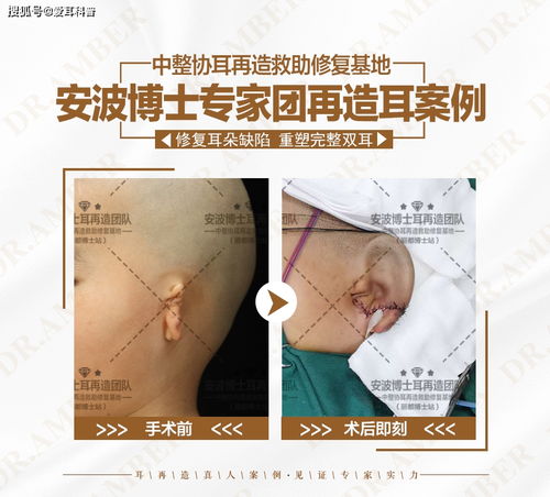 一期梅毒会被误诊成哪些疾病 一期梅毒会被误诊成哪些疾病