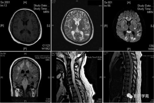 卫计委 医生 警察感染艾滋病纳入职业病范畴 卫计委 医生 警察感染艾滋病纳入职业病范畴