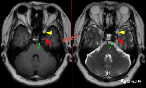 �ܲ��󱳶�����ô����