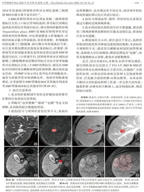 破产姐妹第一季电视剧 破产姐妹第一季电视剧