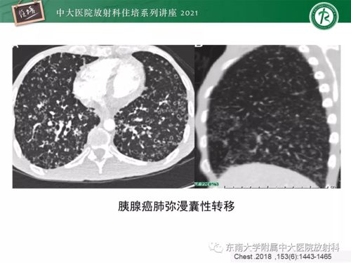 牙床上长个包怎么处理 牙床上长个包怎么处理