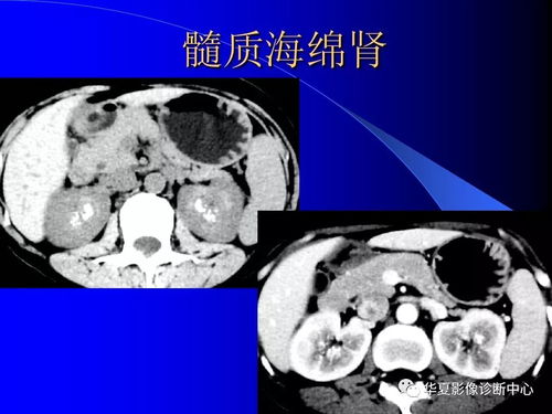 �������ܲ����Գ�ͷ����