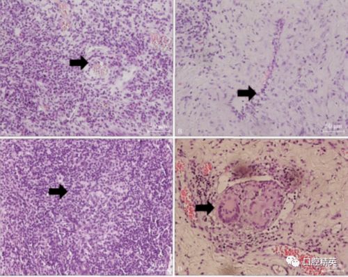 漳州疾控中心艾滋病 漳州疾控中心上班时间表 漳州疾控中心艾滋病 漳州疾控中心上班时间表