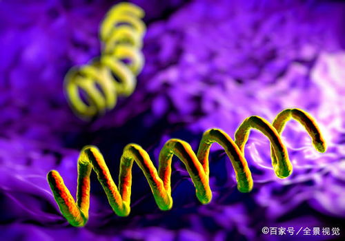 疲劳无力紫斑小心艾滋病 得了艾滋病能治好吗 疲劳无力紫斑小心艾滋病 得了艾滋病能治好吗