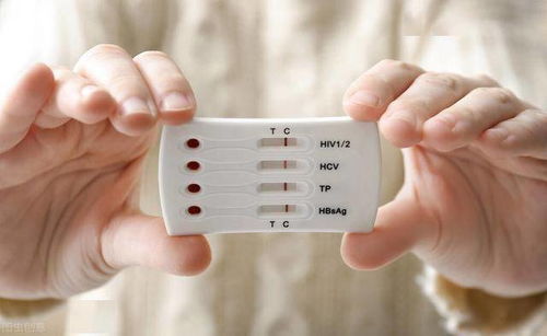 艾滋病预防药物获美药管局批准上市 艾滋病预防药物获美药管局批准上市