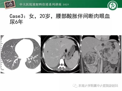 古巨基儿子正面照(古巨基儿子多大了) 古巨基儿子正面照(古巨基儿子多大了)