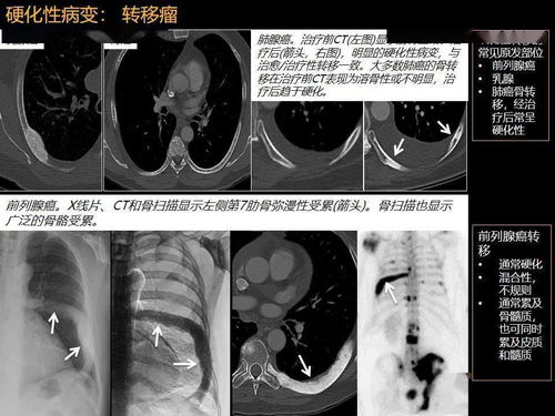 �ܲ�������Ƭ������ ����Ƭ���������������