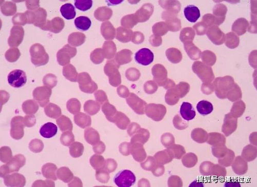 һ�θ�Σ�͸�Ⱦ���ܲ�