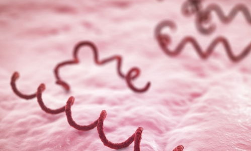 梅毒复发阴部症状梅毒复发是不是又感染了 梅毒复发阴部症状梅毒复发是不是又感染了