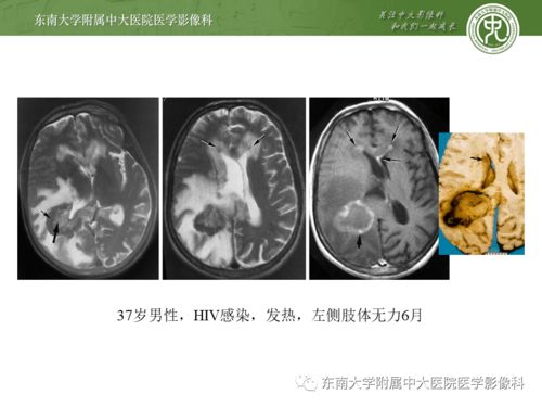 �����ܲ���õ�ƫ��ҩ