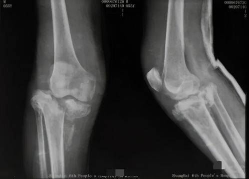 济南哪个医院能治梅毒 济南哪个医院能治梅毒