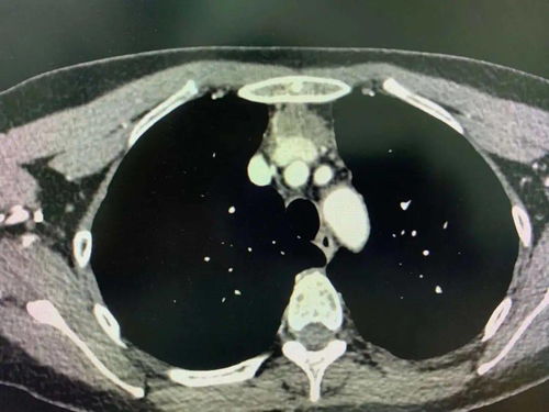 梅毒传播途径及易感人群 梅毒传播途径及易感人群