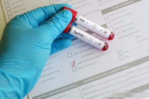 艾滋病检查方法包括什么 艾滋病检查方法包括什么