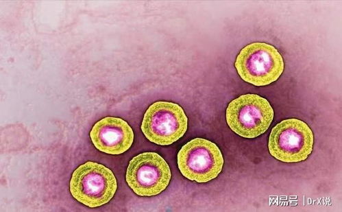 罗京死于艾滋病(罗京艾滋病感染而死) 罗京死于艾滋病(罗京艾滋病感染而死)