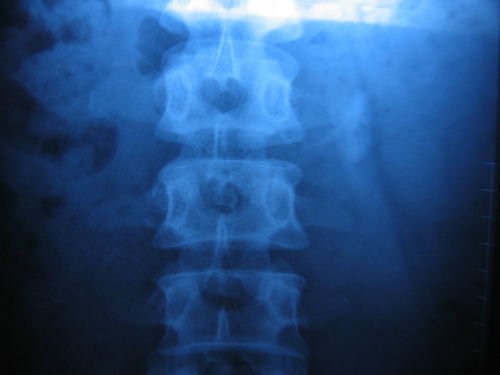 艾滋病的特点 艾滋病的特点