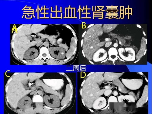 �������ܲ� �ܲ��Ǹ�������·��Ⱦ��