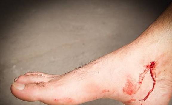 脚脖子酸是怎么回事 脚脖子酸是怎么回事