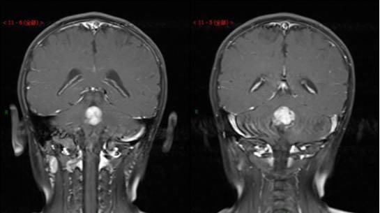 ʹ ˱и÷HIVҽδ֪ ŮȾ