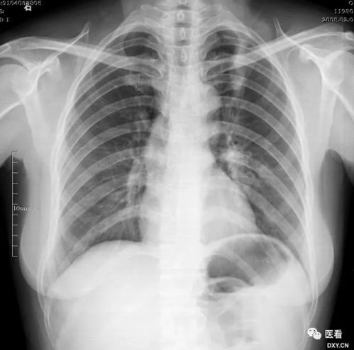 ���̲��ᱻ���Ӵ�Ⱦ��