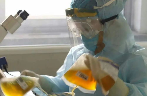 感染上艾滋病病毒怎么办 感染上艾滋病病毒怎么办