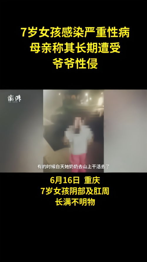 艾滋病感染前提 艾滋病感染前提是什么 艾滋病感染前提 艾滋病感染前提是什么