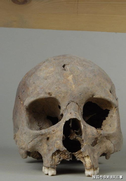 宝宝打预防针后感冒了怎么办 宝宝打预防针后感冒了怎么办