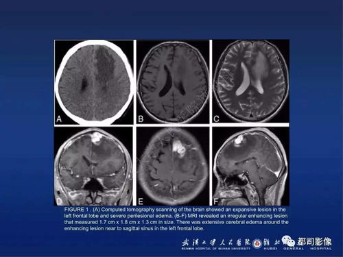 ���̲�����ʷ�����ͼ���֢״�����̲�����ʷ�� 