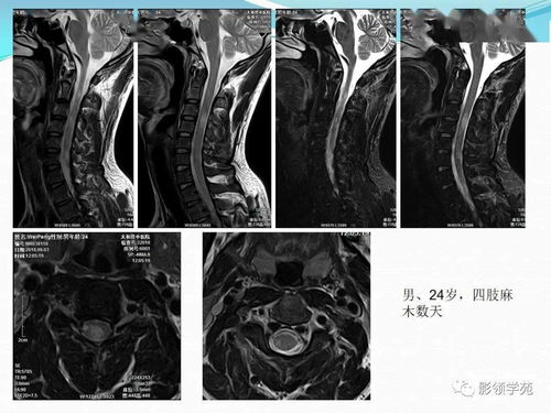 头晕要检查什么项目 头晕要检查什么项目