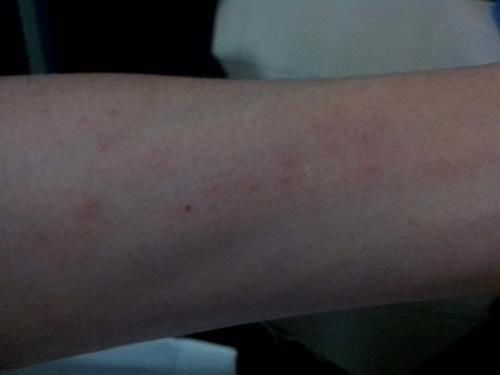 艾滋病患者是否能生孩子 艾滋病患者是否能生孩子